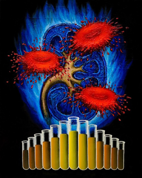 W'UP★6月14日～6月27日　まなざし－生と病を描く－　日本橋N11ギャラリー（中央区日本橋本町）